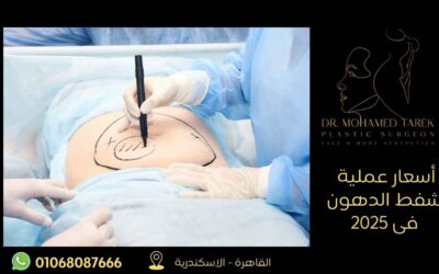 اسعار عملية شفط الدهون في 2025